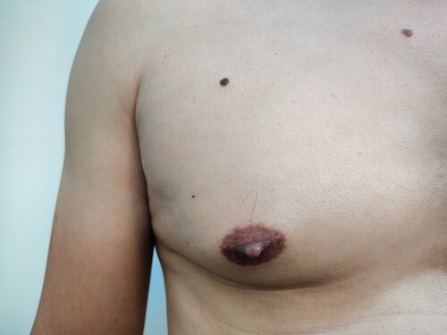 ben whalley recommends www puffynipples com pic