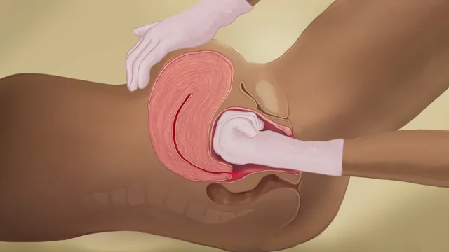 afonso faria recommends Uterus Porn