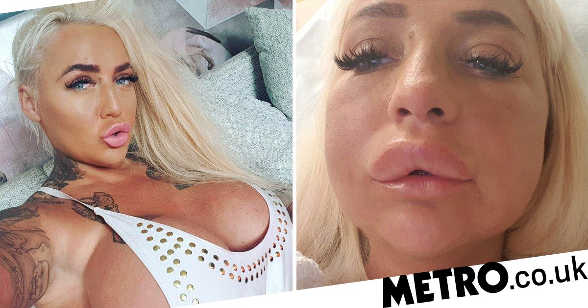 Best of Plastic surgery porn